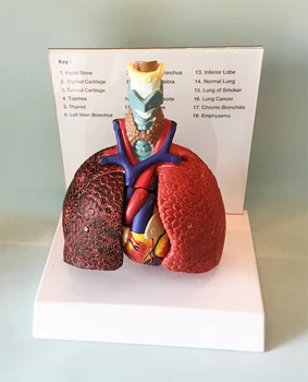 анатомическая модель горла, сердца и легких человека Модель легких, сердца, горла, трахеи, лимфатических узлов Обучение торакальной хирургии